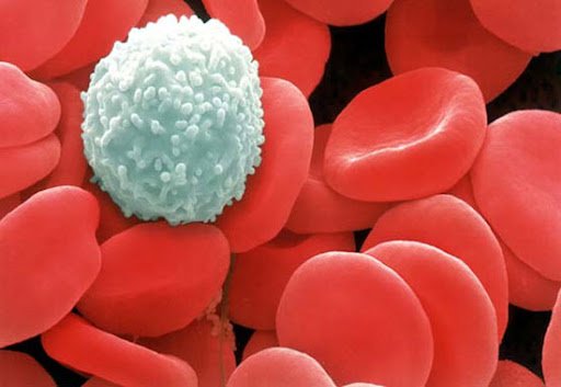 Ung thư máu có chữa được không? Ung thư máu sống được bao lâu